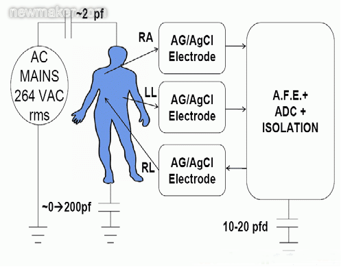 心电图(ECG)设计六大挑战与解决方案(图1)